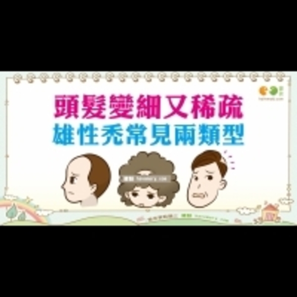 雄性禿的種類｜男性 落髮篇4