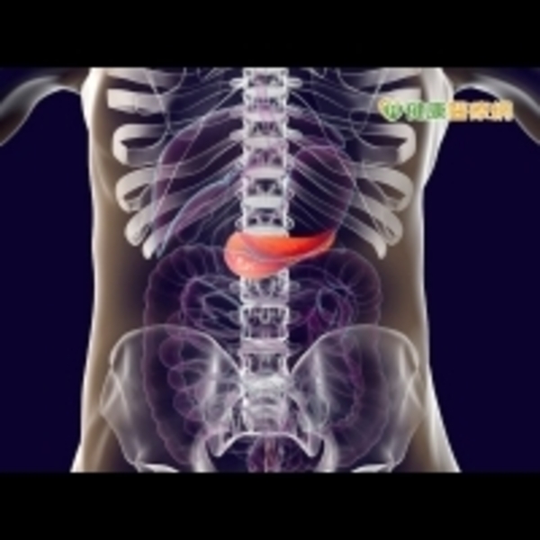 糖友慎防胰臟炎　這些致病因要小心