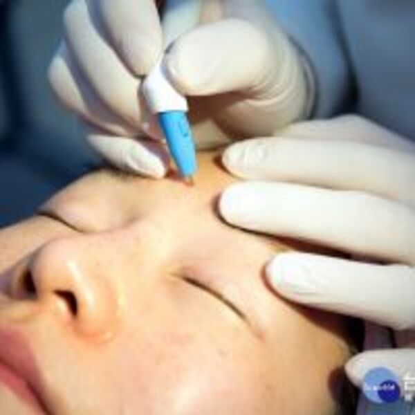 打擊眼袋、雙下巴　集效電波抗老新神器