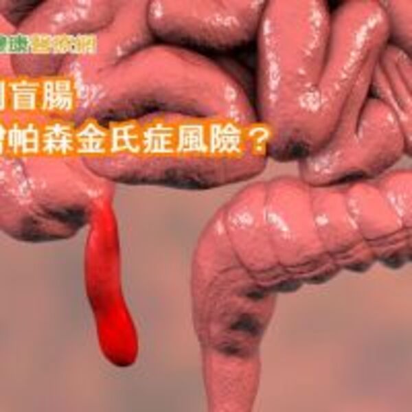 割闌尾與帕森金氏症有關？　研究：風險很小