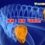 拔智齒且慢？　留下來竟有「這用途」