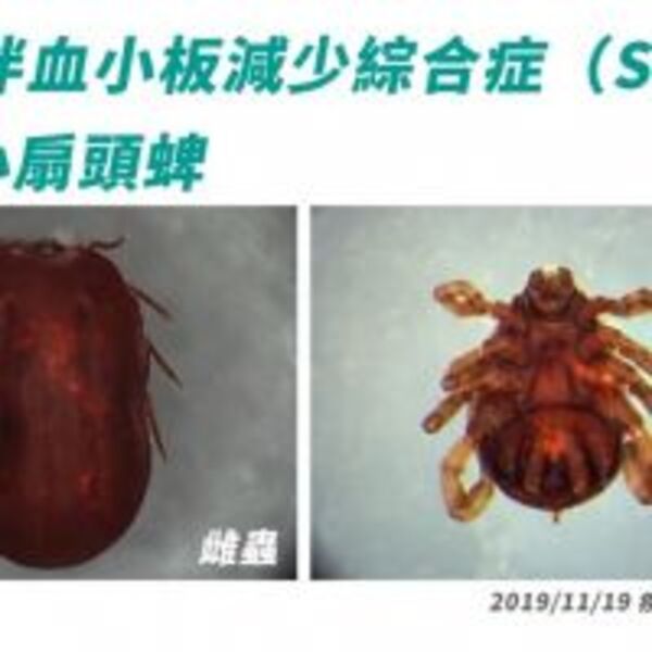 症狀似登革熱　台灣現首例SFTS病例　防蜱蟲叮咬為上策