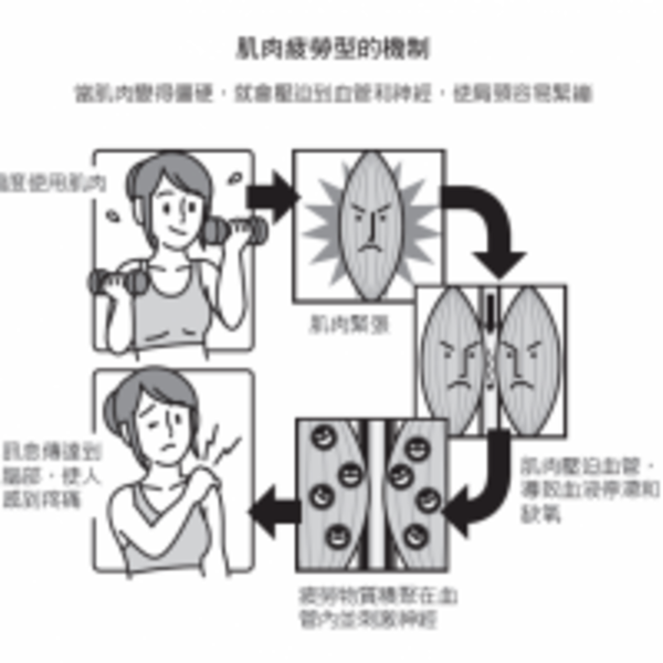 7種類型，引起肩頸周圍不適的原因？5秒除肩、頸、背痠、止住頭痛...