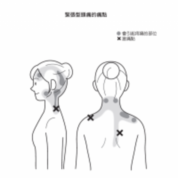 5秒解痛！如何「按揉鎖骨」，消除肩、頸、背痠、止住頭痛，物理治療師教你這樣做...