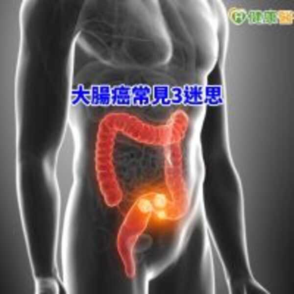 大腸癌常見3迷思　專科醫師一次說清楚