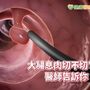 大腸息肉不是全部都切？　醫：看這點決定