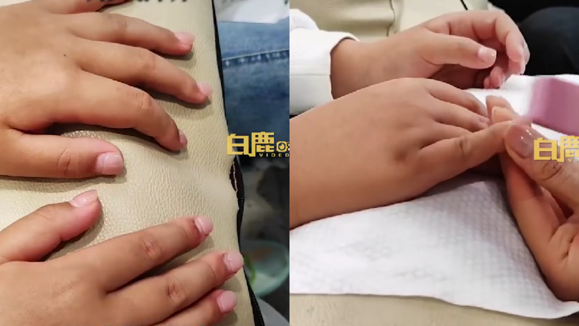 10歲男童愛咬指甲！父母帶他去做美甲　實測3週「真的不咬了」
