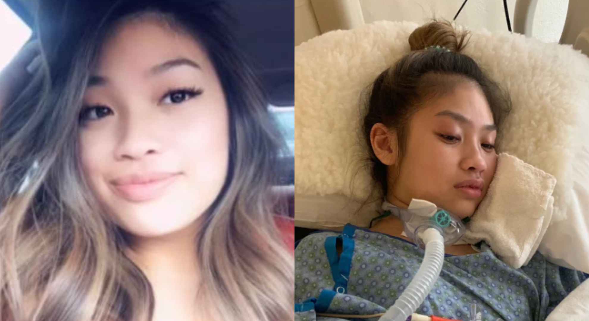 18歲女豐胸手術中心跳驟停醫師不讓報警躺手術台5小時腦死身亡
