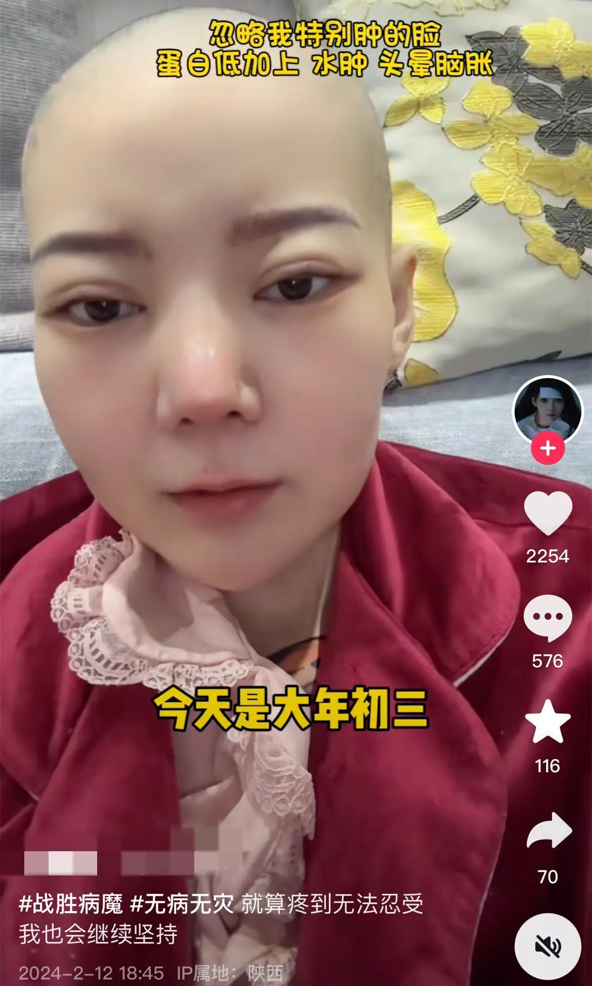 中國28歲網紅菲菲公主驚傳胃癌病逝生前最後畫面曝光