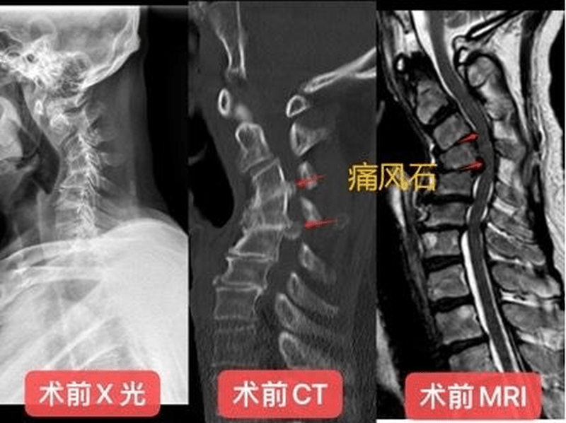 新聞圖片