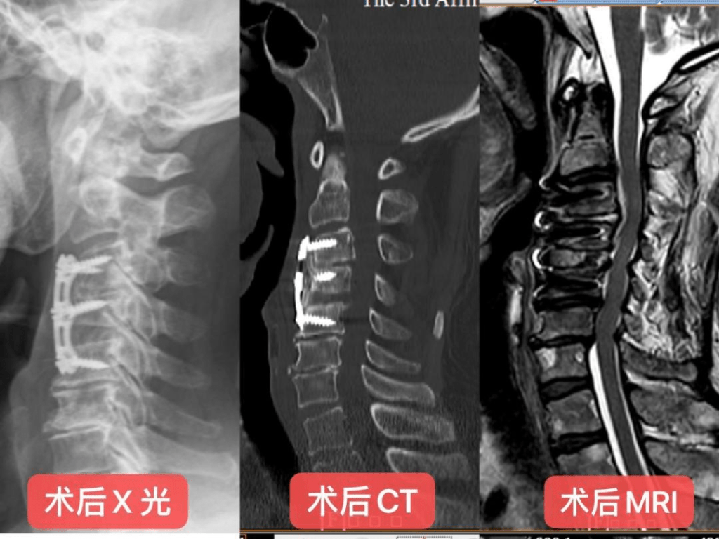 新聞圖片