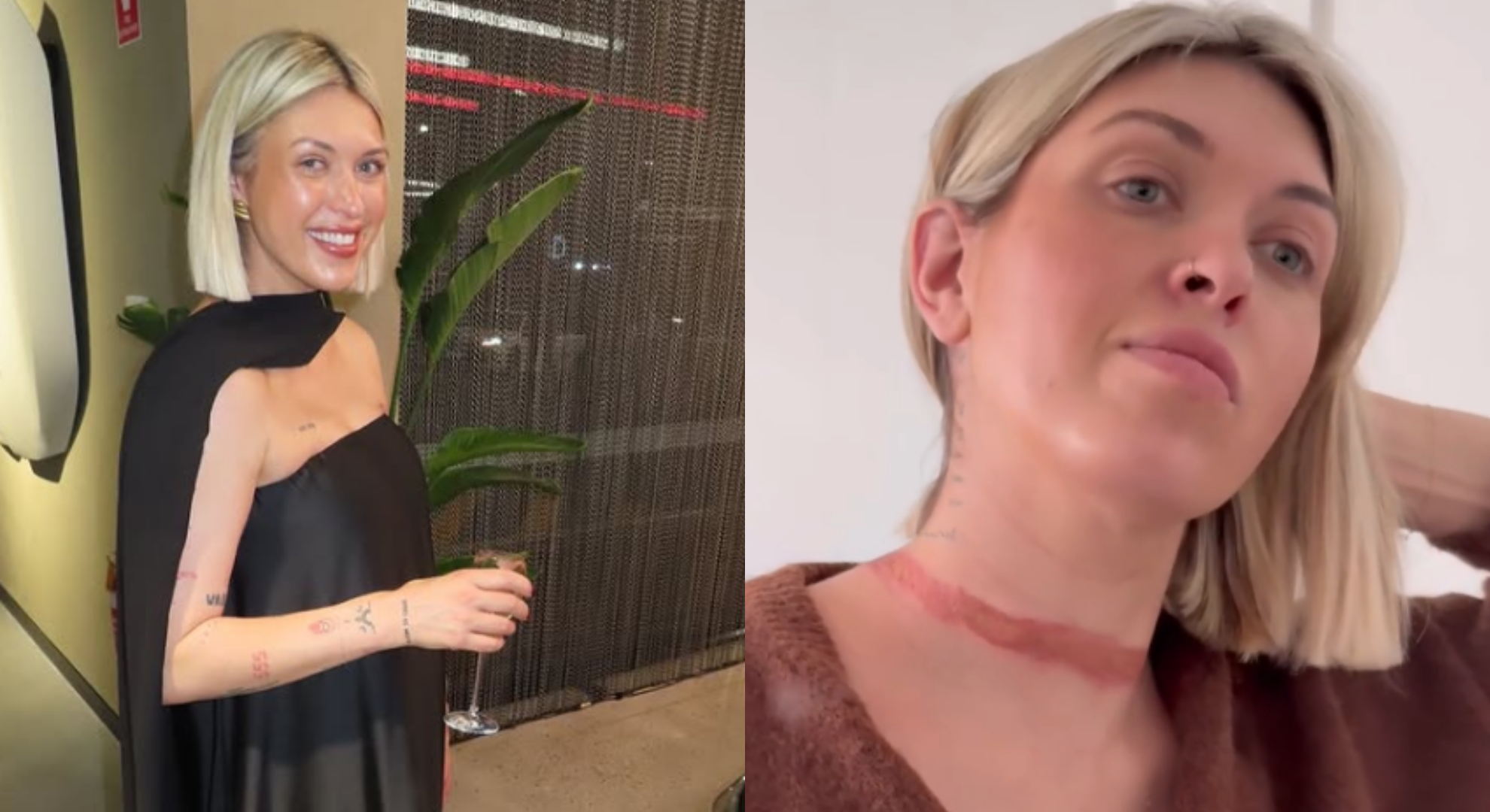 女穿禮服「布料突捲車底」！脖子勒出深深血痕險　驚恐：差點把我勒死