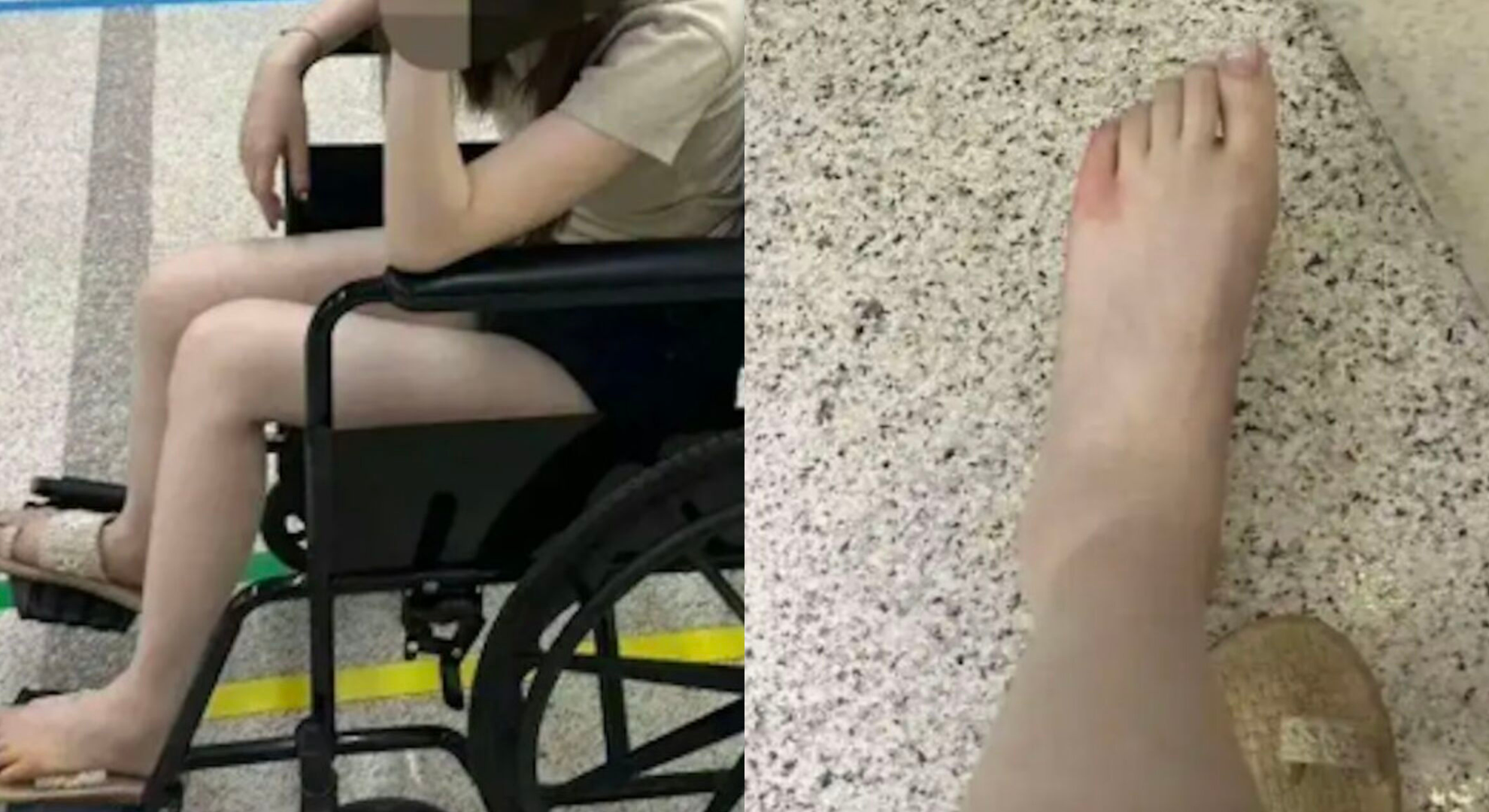 中國五星飯店出事！女吃一半遭蜈蚣咬傷　業者祭「補償」女轟：意義很小