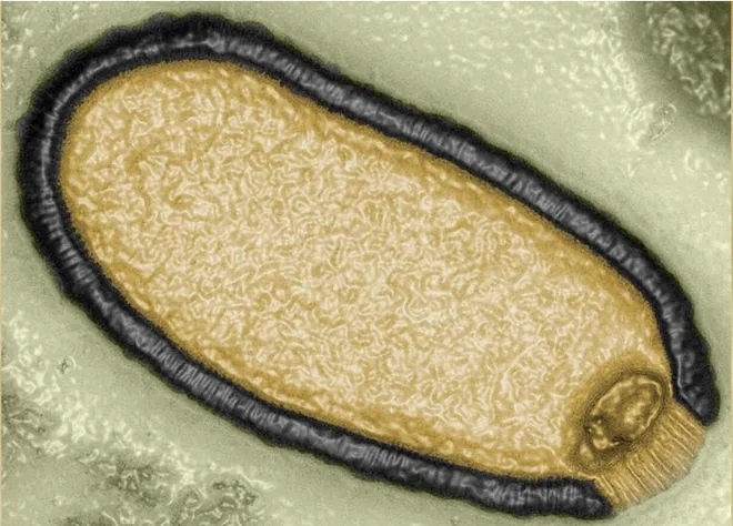 又來！4.8萬年木乃伊級「殭屍病毒」逆襲復活　學者嘆：還是有傳染性