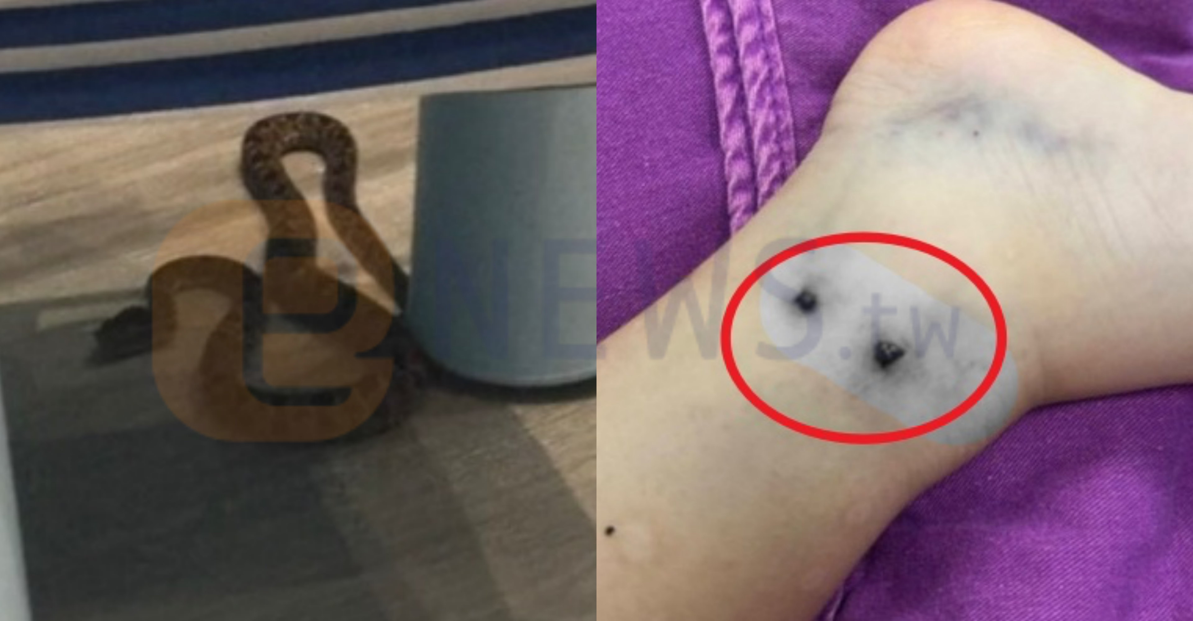 家長注意！社區遊戲室驚現毒蛇龜殼花　5歲童遭咬傷送醫搶救