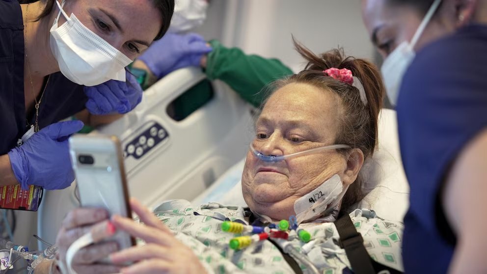 全球第2人！54歲重症女「接受豬腎移植」88天後不幸逝世