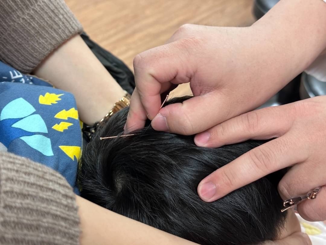 中醫大結合雷射針灸治療 遲緩兒癲癇頻率降低、生活自主能力提升