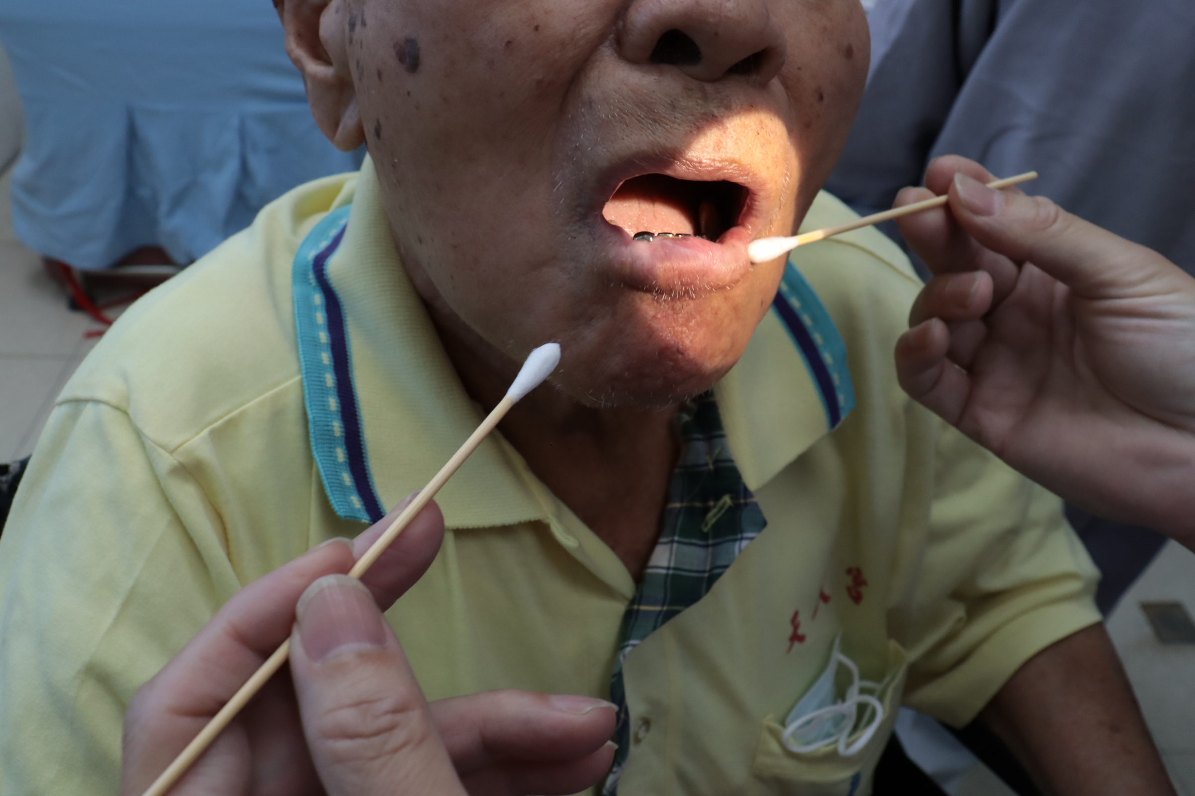  嘴破越腫越大！90歲翁「唇下掛3cm腫瘤」　戒檳榔10年二度罹癌