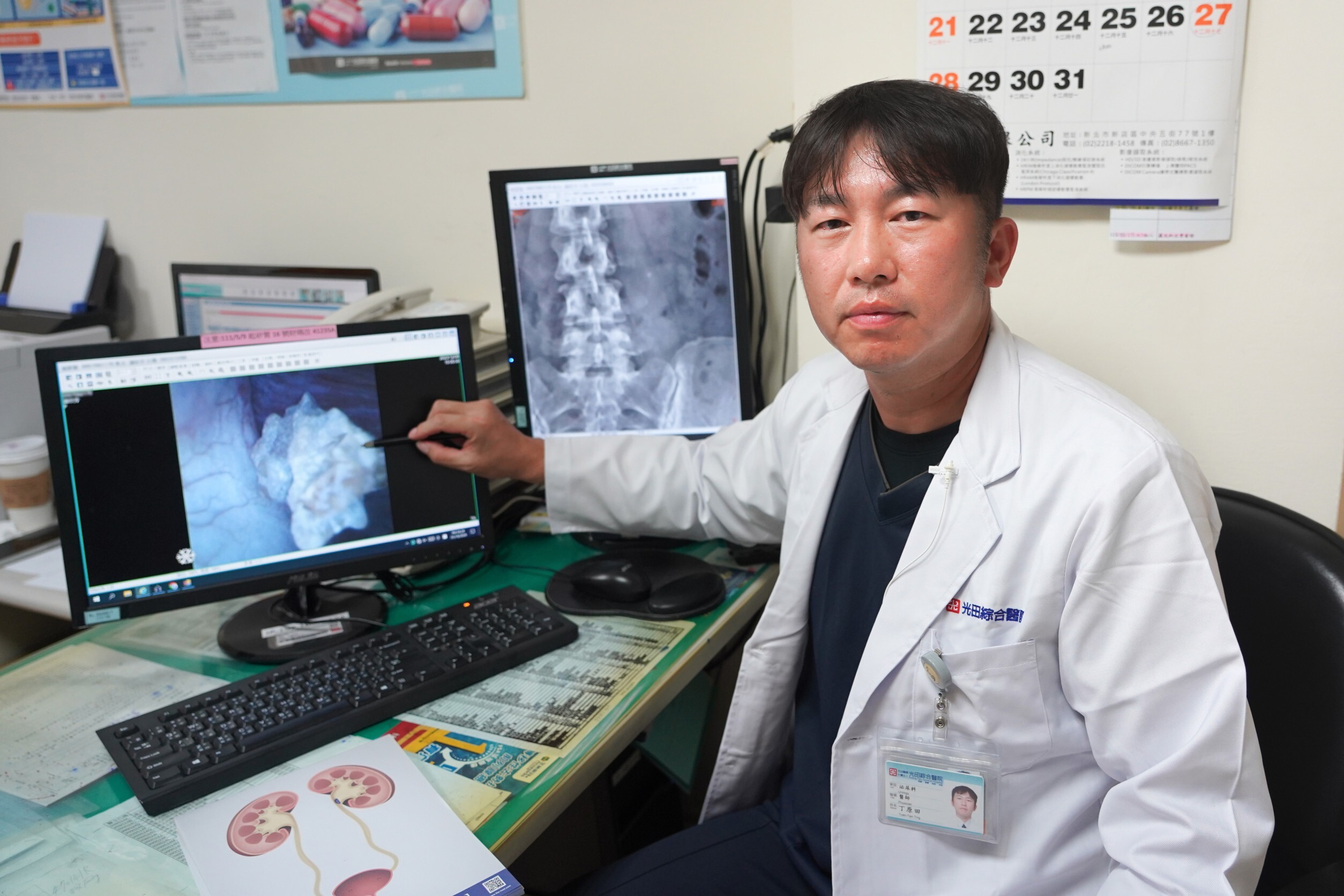 頑強結石「震不碎」!闆娘腎臟深處痛不欲生 醫新式輸尿管鏡一夾出