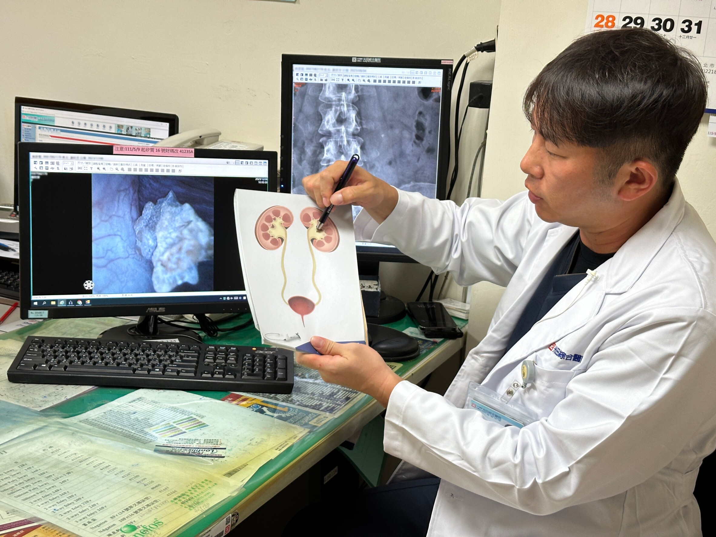 頑強結石「震不碎」!闆娘腎臟深處痛不欲生 醫新式輸尿管鏡一夾出