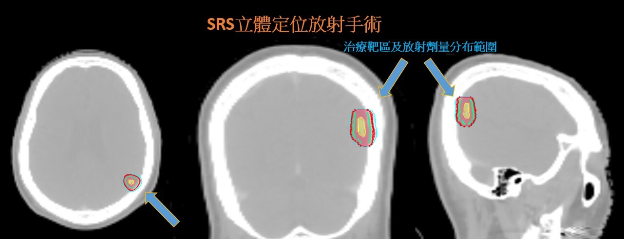 新聞圖片