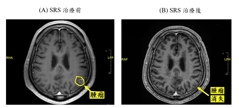 新聞圖片