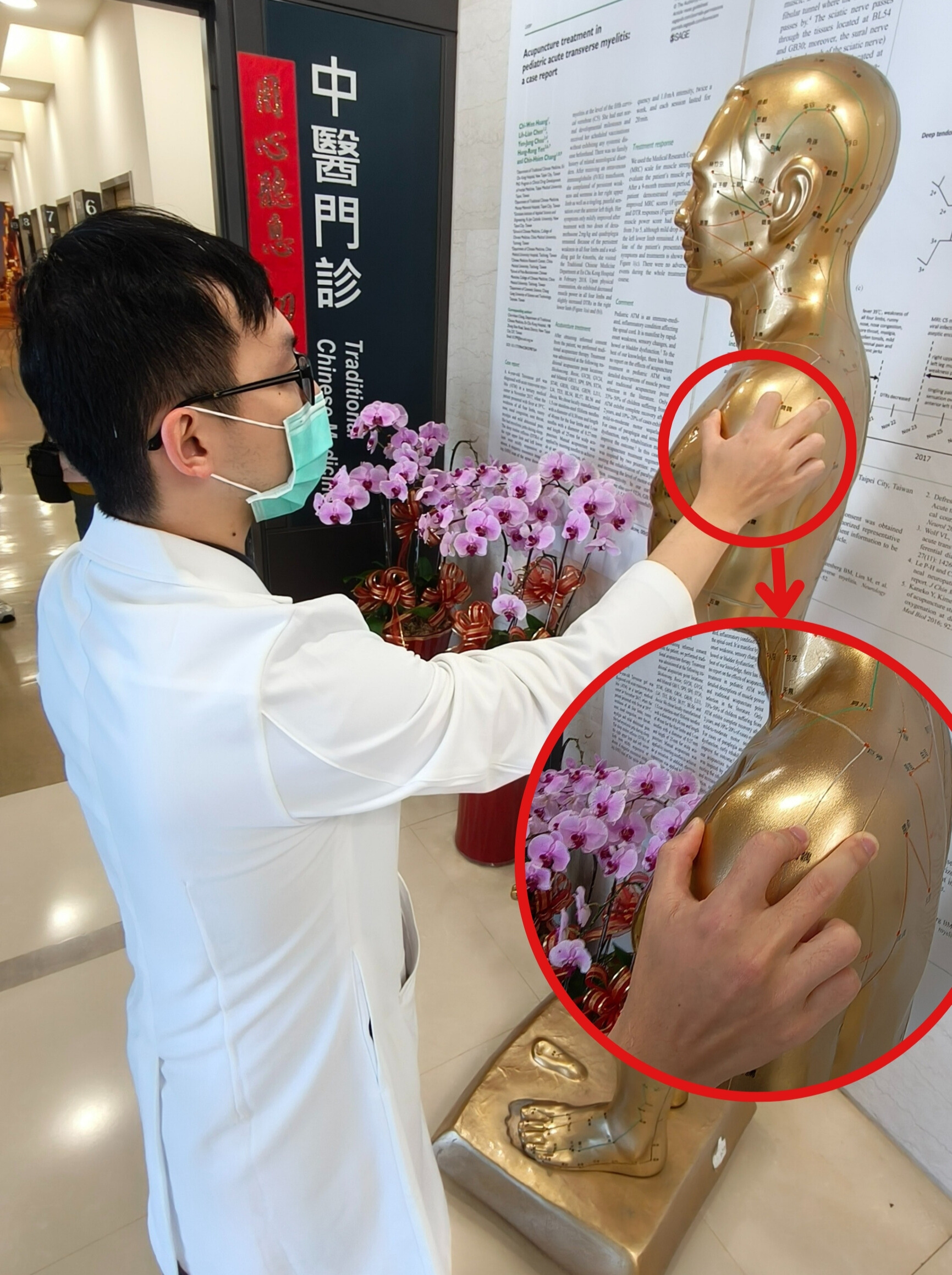 年輕人也中招!五十肩不再是中老年專利,專家提醒及早治療