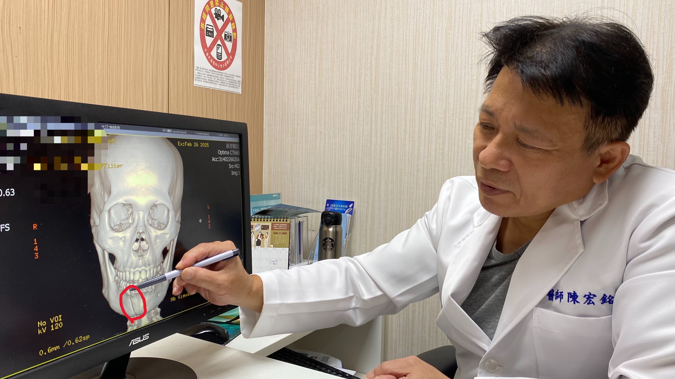 兩歲童意外撞斷母親鼻骨,專家提醒顏面骨折黃金治療期