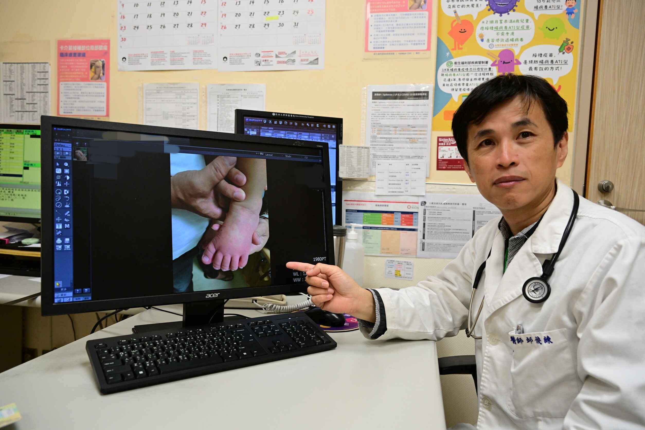  2歲男童高燒不退 川崎病險釀危機