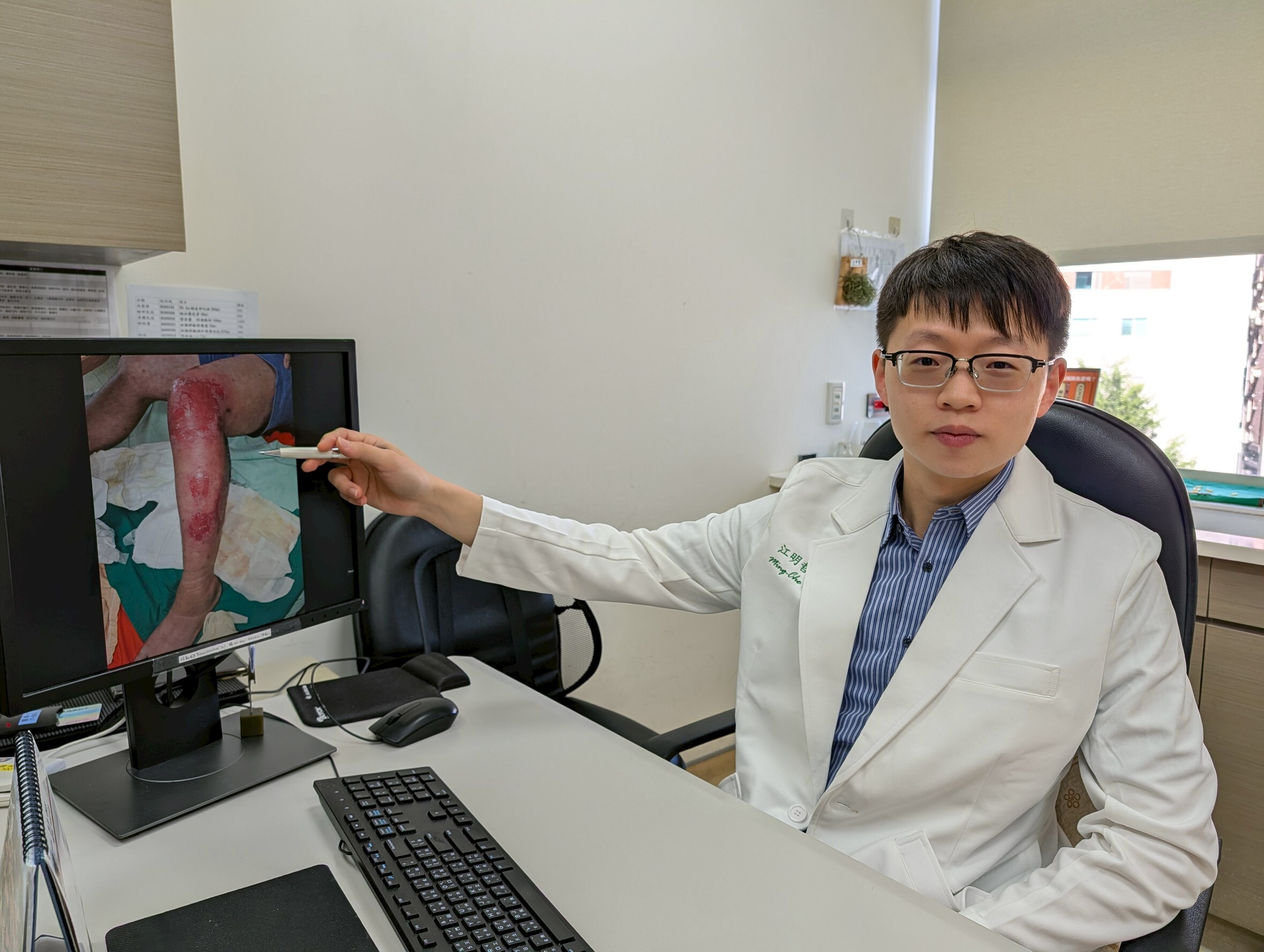 冬季乾癢別小看！60歲男泡腳+擦酒精　皮膚「裂口紅腫」確診1病